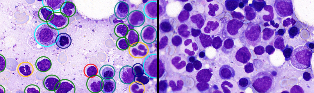 Cancilico Raises €2.5M to Scale AI-Powered Bone Marrow Diagnostics